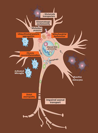 Motor Neuron Disease Stem Cell Treatment Center NeuroGen BSI